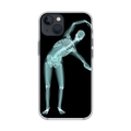 First Love Skeleton phone Case