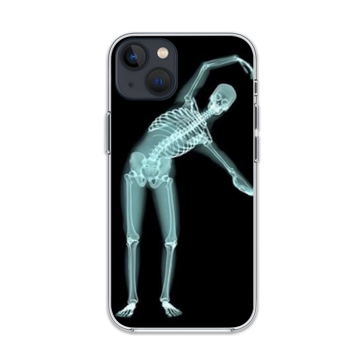 First Love Skeleton phone Case