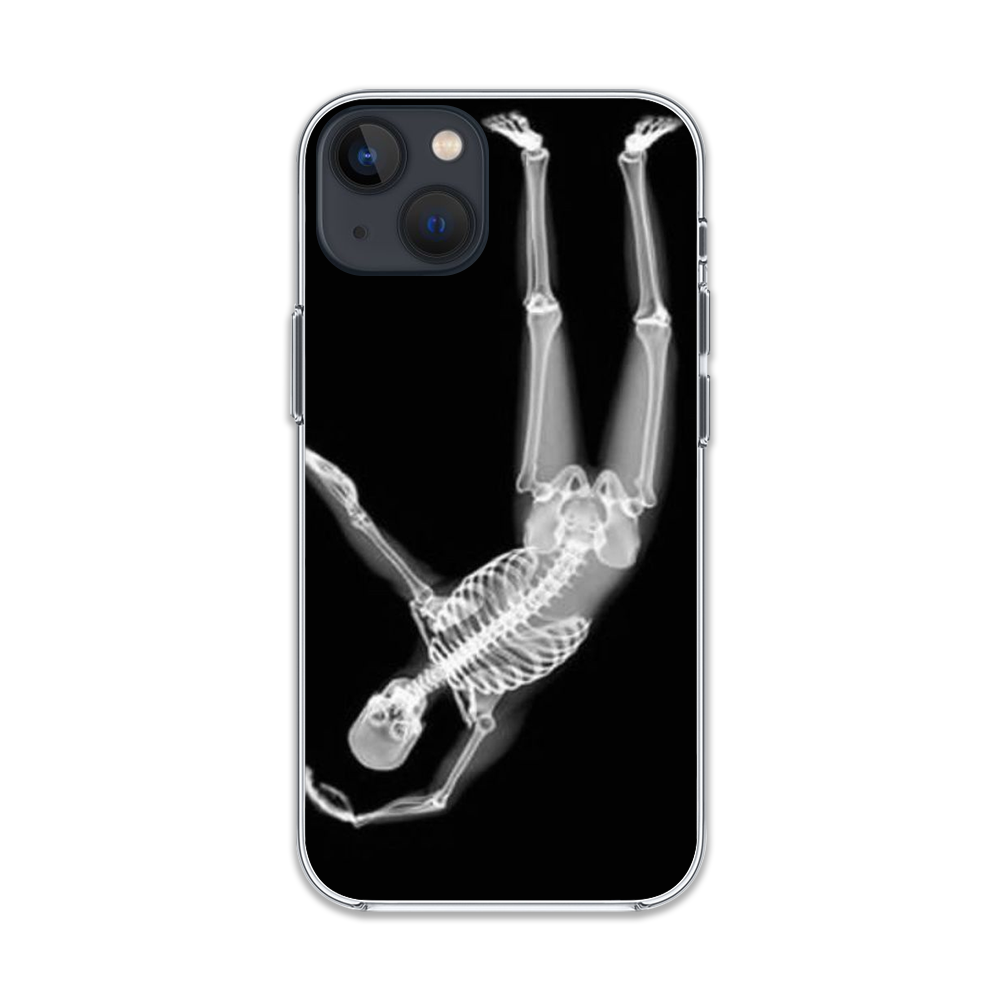 Love Skeleton phone Case