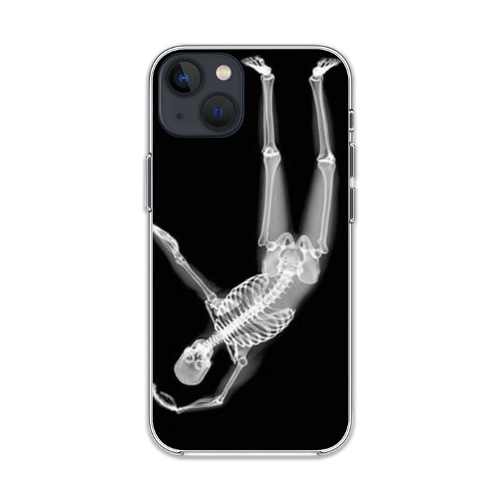 Love Skeleton phone Case